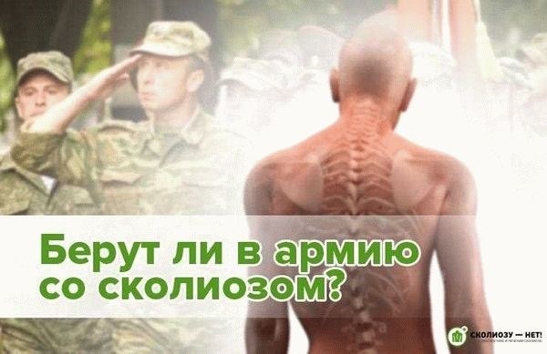 Как определить годен ли призывник к военной службе?