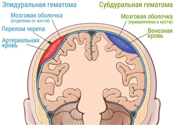 Что, если я не хочу служить в армии